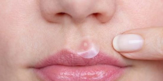 Mejores parches para granos 2023 ✅